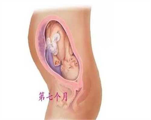 听说武汉代孕妇脚肿怀的是儿子，这是真的吗