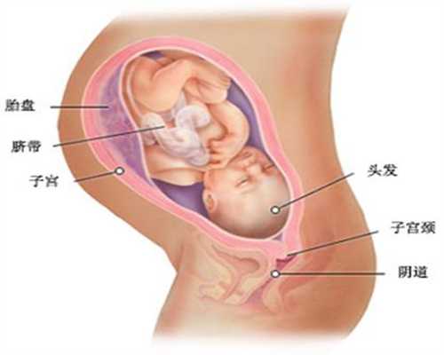 代孕早期出血，正常情况与非正常情况，代孕妈