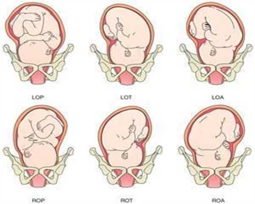 怀代孕后一定不能做的5件事，很容易出现“胎停
