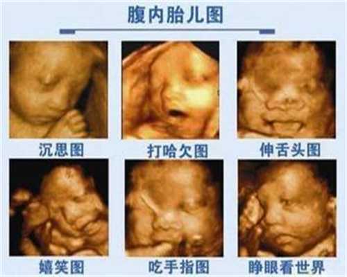 卵巢囊肿影响深圳代孕,试管婴儿短方案和长方案