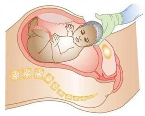 拯救湿疹代孕宝宝 夏天治疗湿疹的方法有哪些？