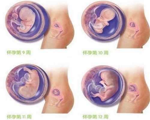 为啥备孕二胎连续胚停？想要二胎怎么这么难？”